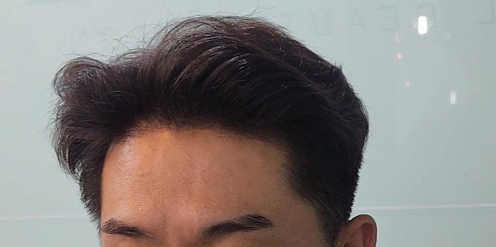 정 헤어라인 이미지