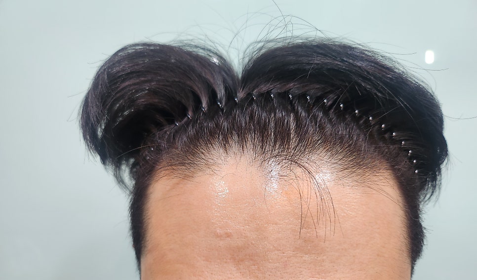 뷰티헤어라인 이미지
