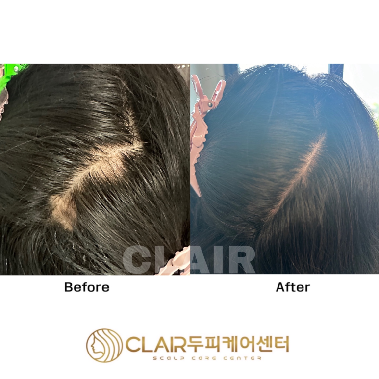 클레르두피케어센터 이미지