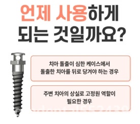 스크류비어 이미지