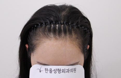 더헤어라인성형외과의원 이미지