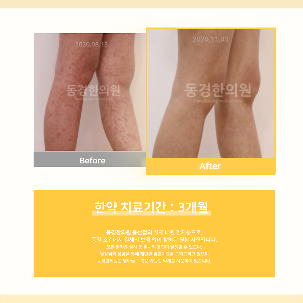 평안반점 이미지