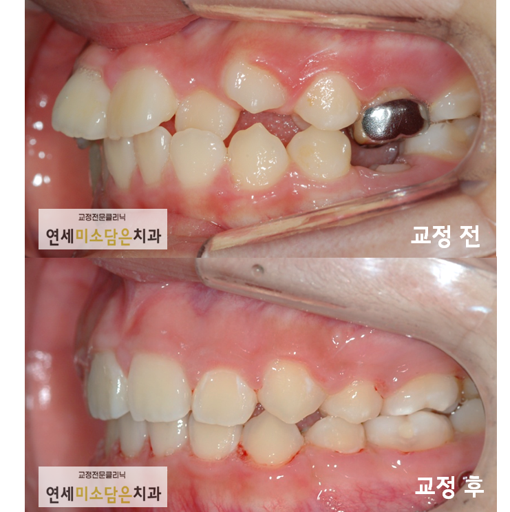 연세미소담은치과 이미지