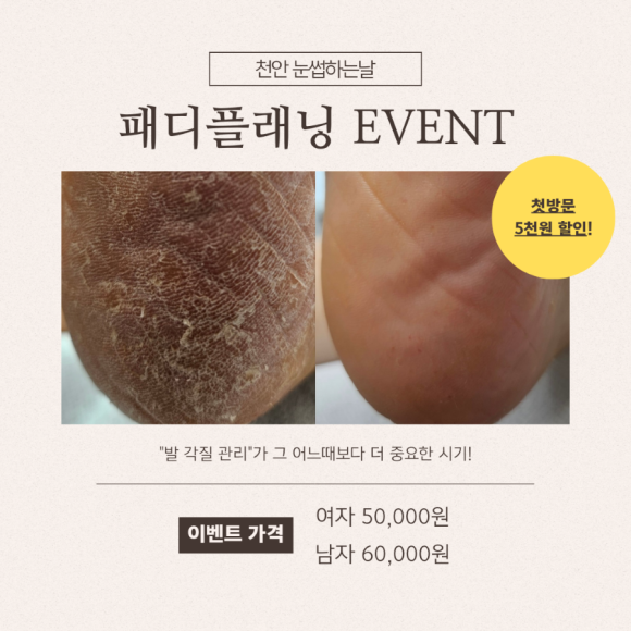 고바우샵 이미지