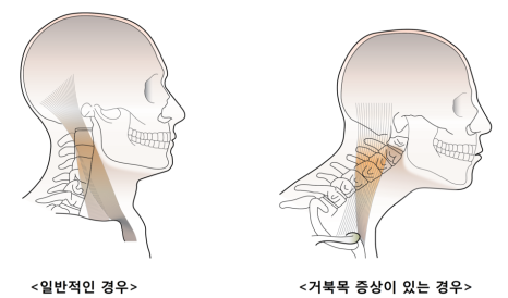 053짐 이미지
