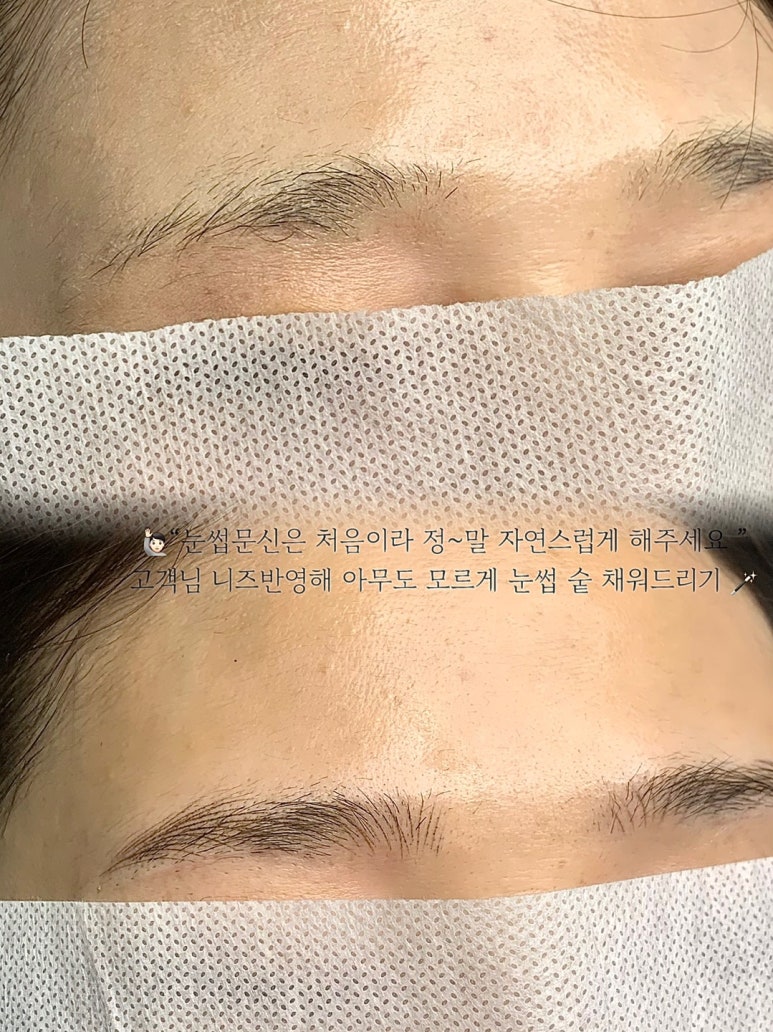 다움스킨 이미지