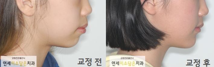 연세미소담은치과 이미지