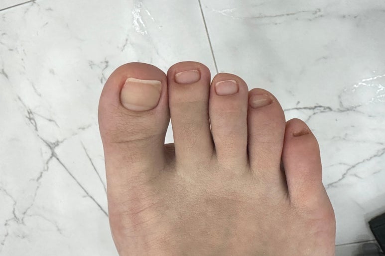 멋진발관리 이미지
