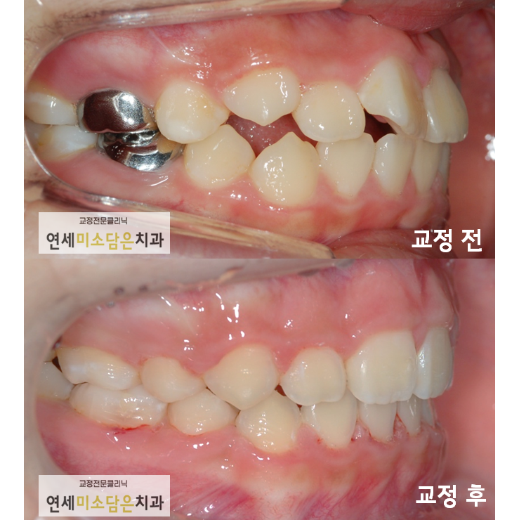 연세미소담은치과 이미지