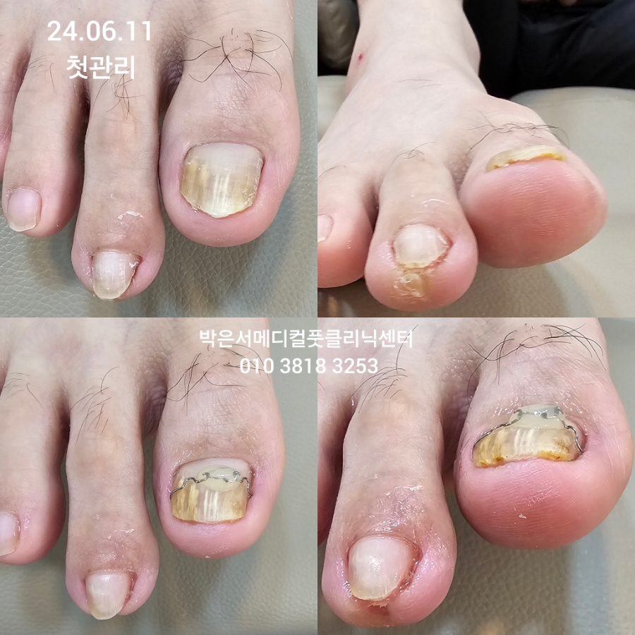 박은서메디컬풋클리닉센터 이미지