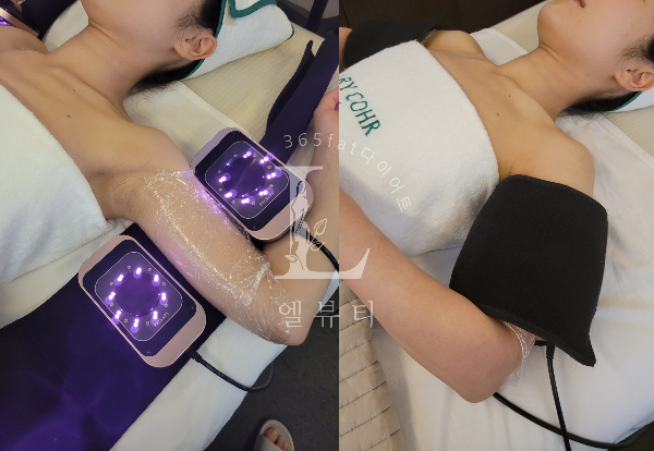 365뷰티라인 이미지