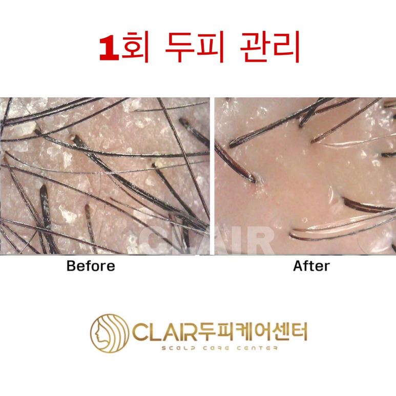 클레르두피케어센터 이미지