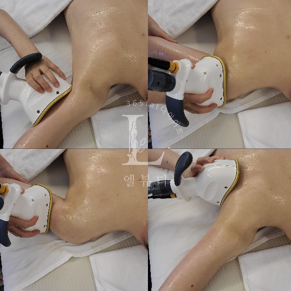 365뷰티라인 이미지