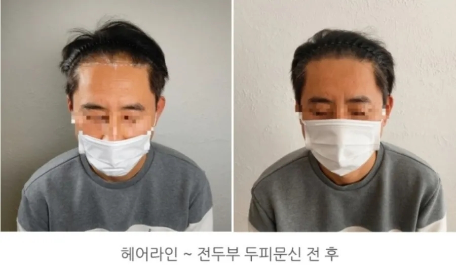 헤드라인유 이미지
