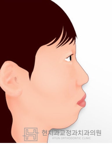현치과교정과치과의원 이미지
