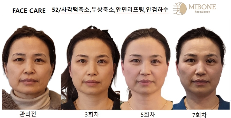 (주)미본 이미지