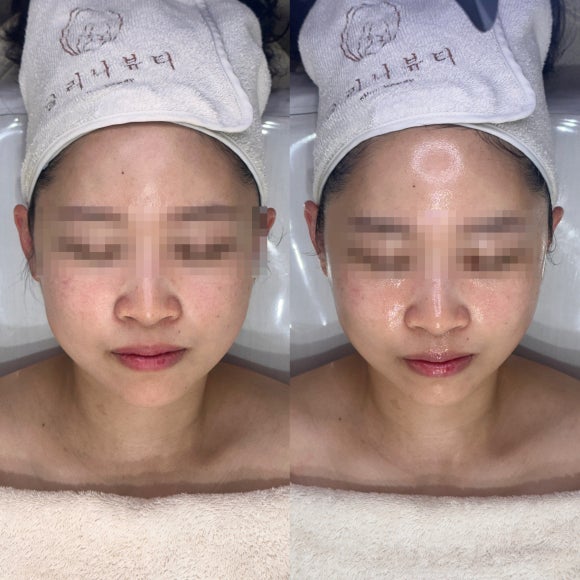 글리나뷰티 이미지