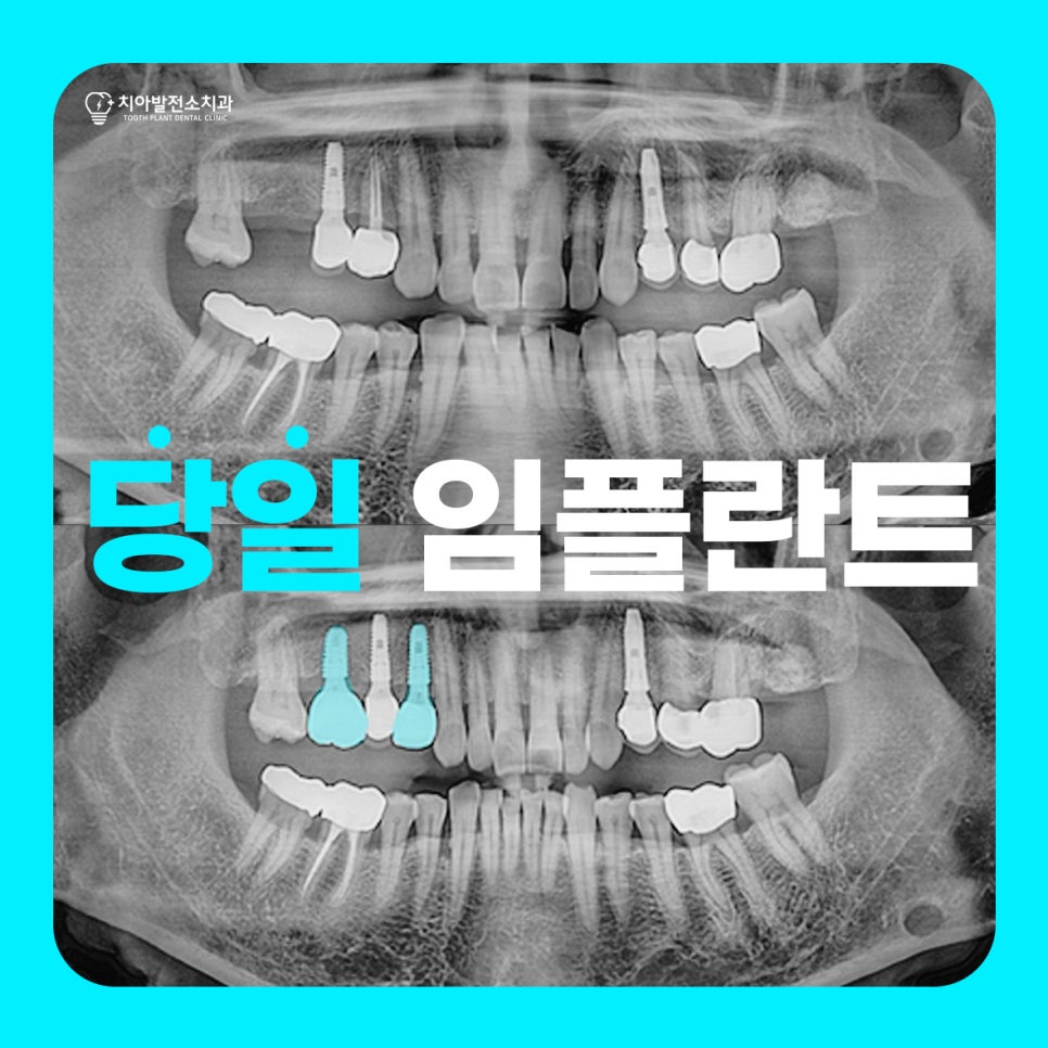 치아발전소치과의원 이미지
