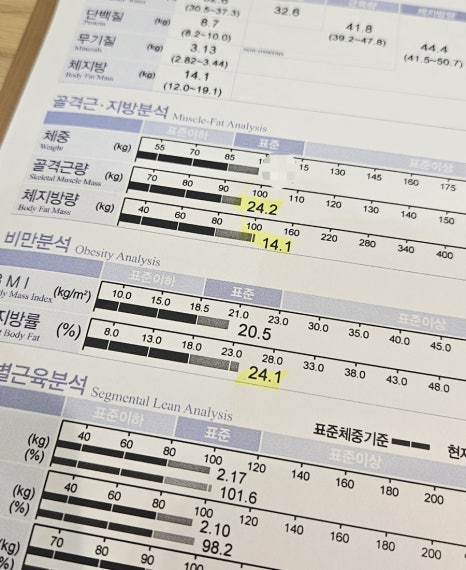 에소코핏 일산점 이미지