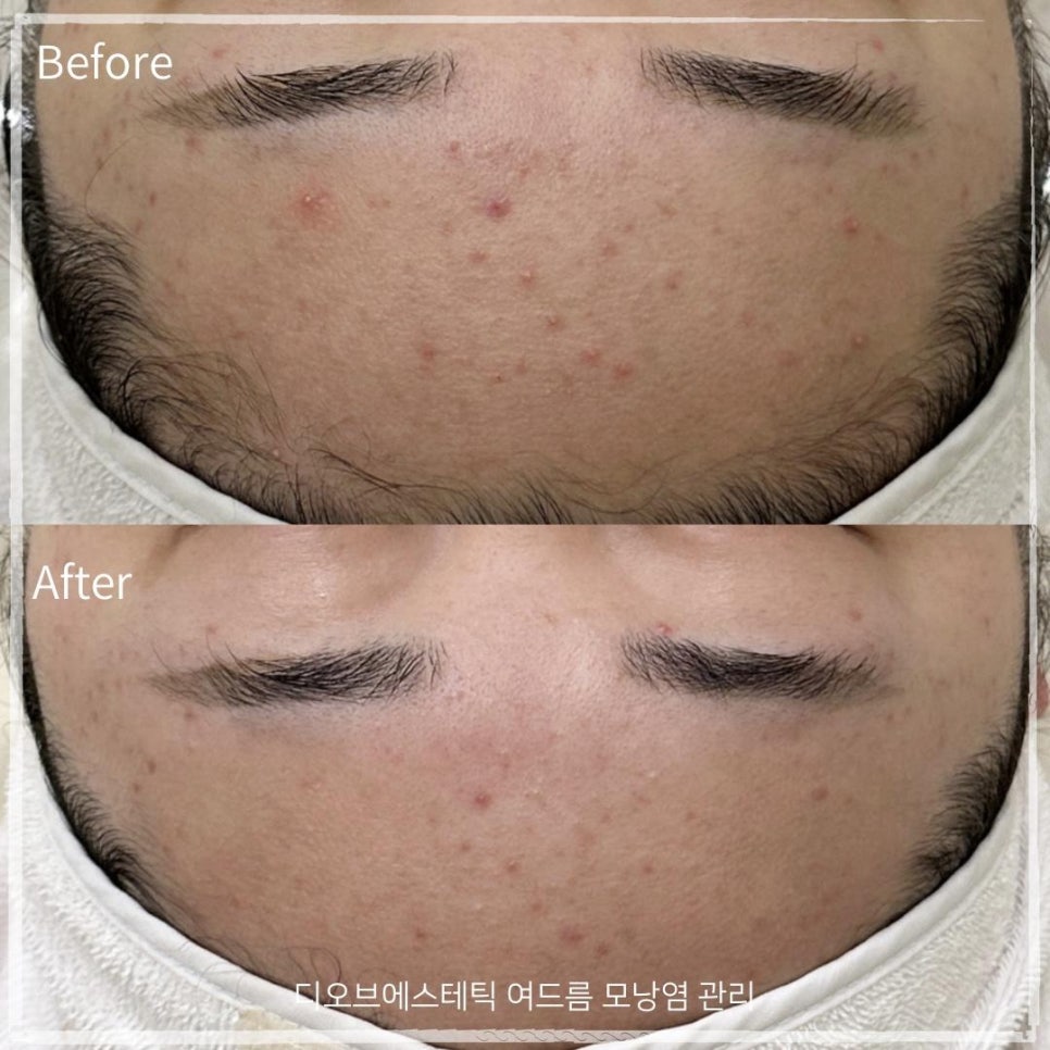 청에스테틱 이미지