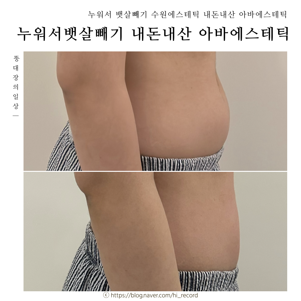 아바에스테틱 이미지