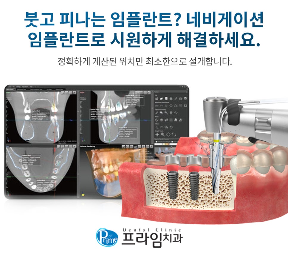 광교상현컴퓨터 이미지