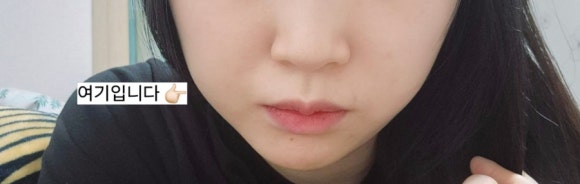 더봄구강악안면외과치과의원 이미지