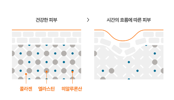 진피오니 이미지
