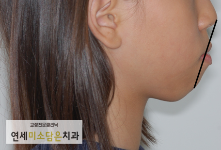 연세미소담은치과 이미지
