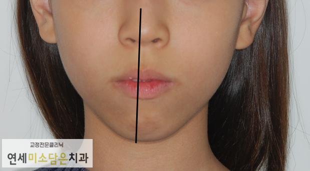 연세미소담은치과 이미지