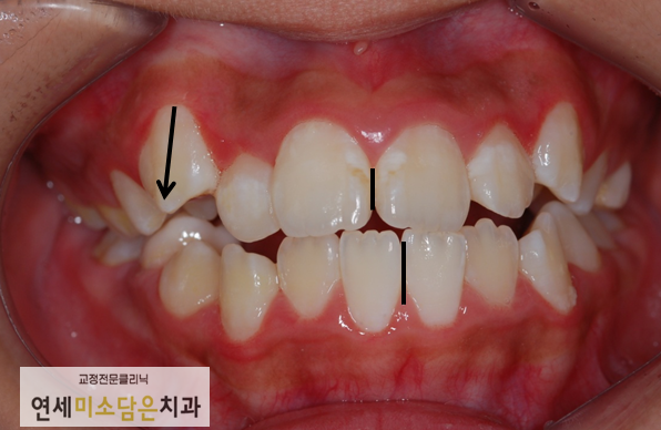 연세미소담은치과 이미지