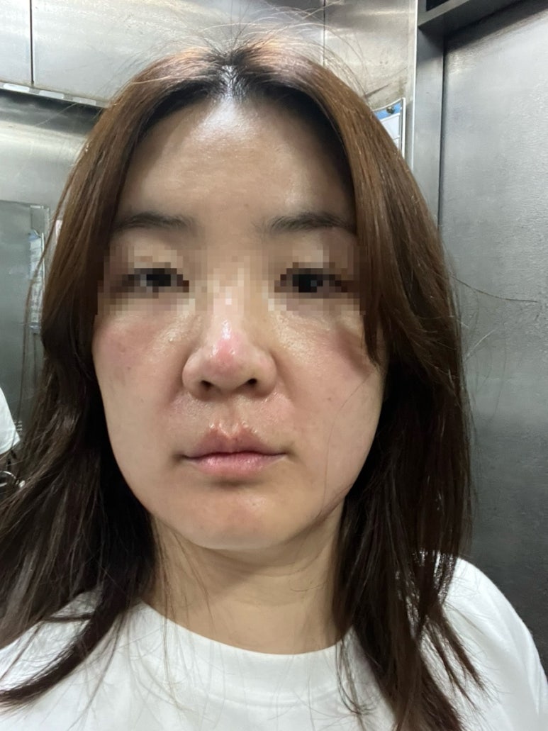 아비쥬의원부평 이미지