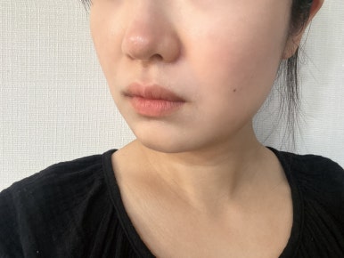 미소지앤 에스테틱 이미지