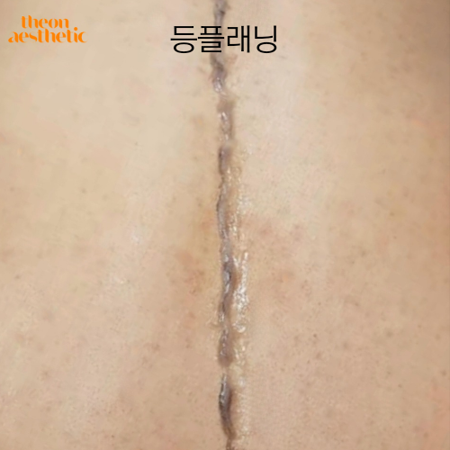 더온 이미지