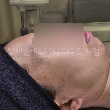 대구탑홈케어 이미지