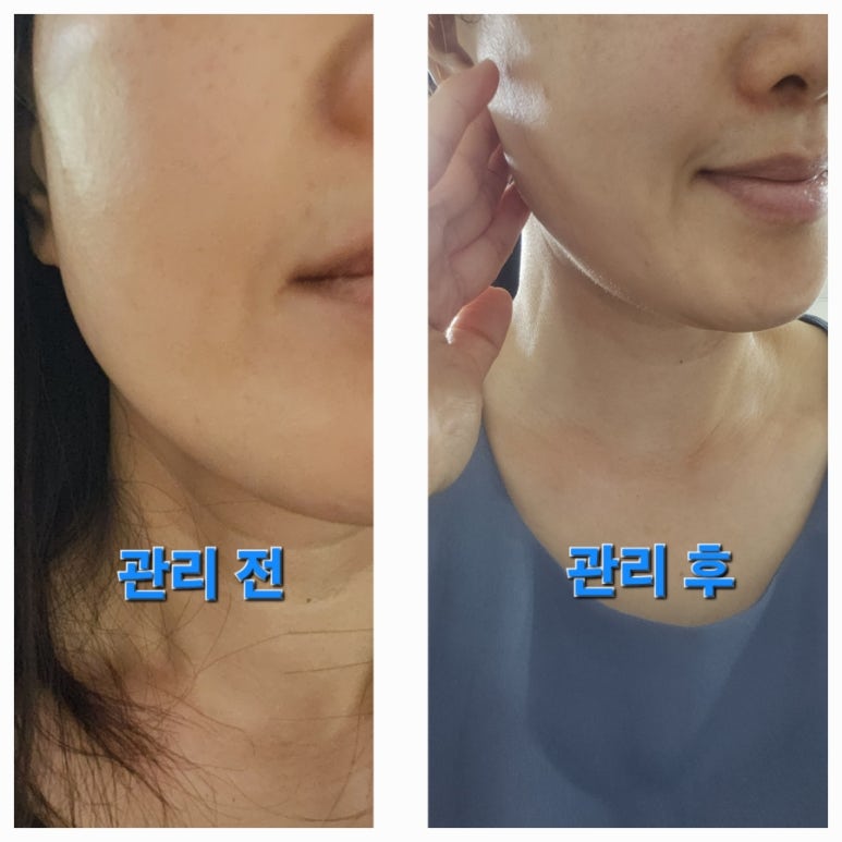 아미고에스테틱 이미지