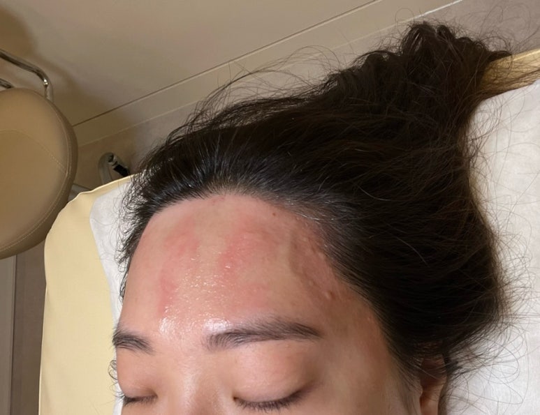 퀸헤어라인 이미지