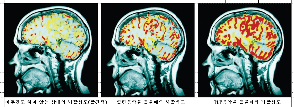 썬앤미뇌과학최경민 이미지