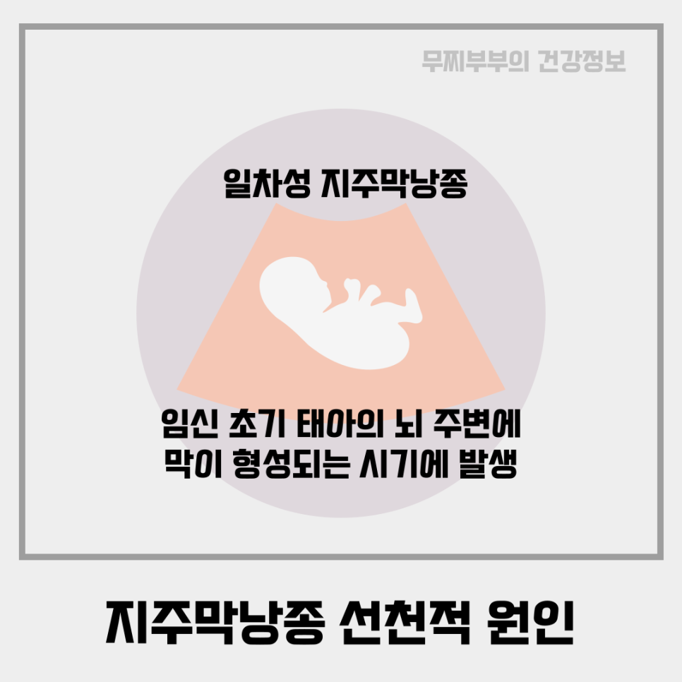 선천가설 이미지