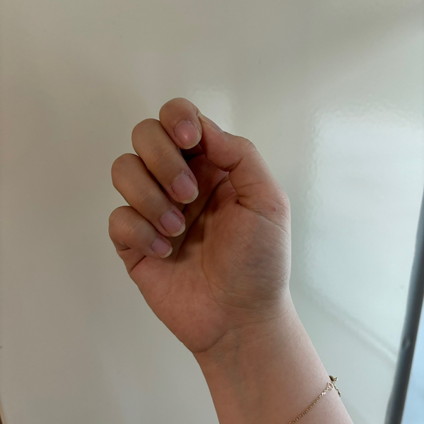 팡이네일 이미지