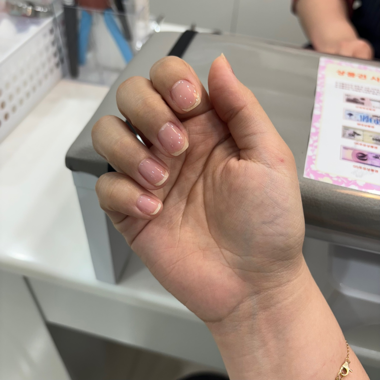 팡이네일 이미지