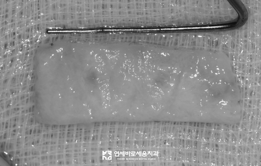 바로세움치과 이미지