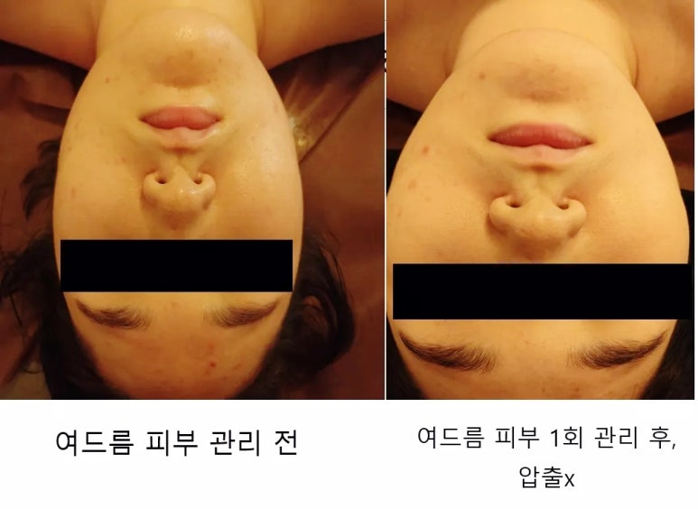 로뎀스킨케어 이미지
