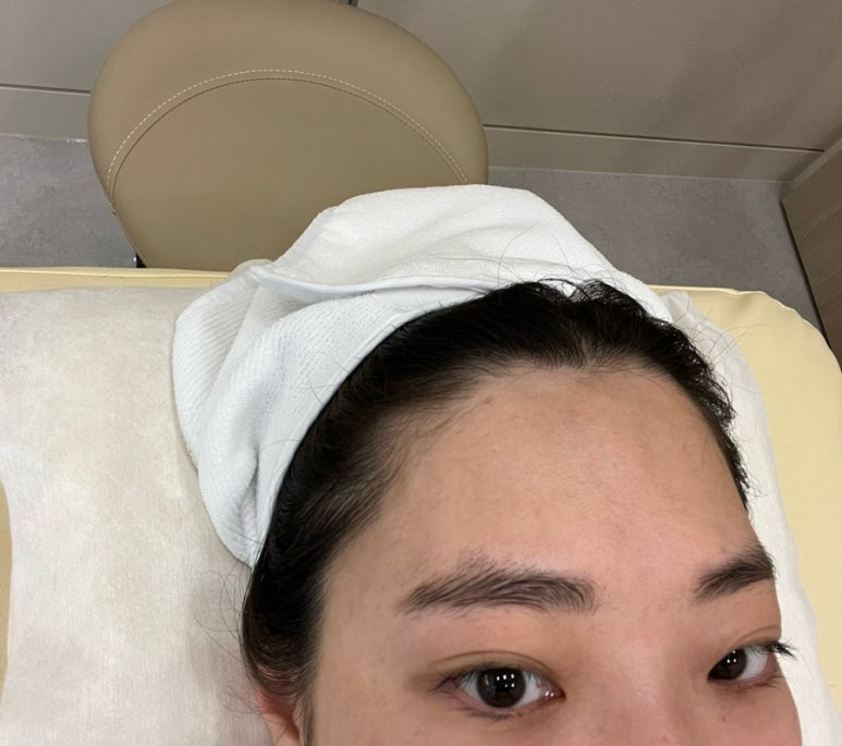 퀸헤어라인 이미지