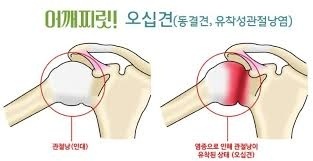 약손통증전문 이미지