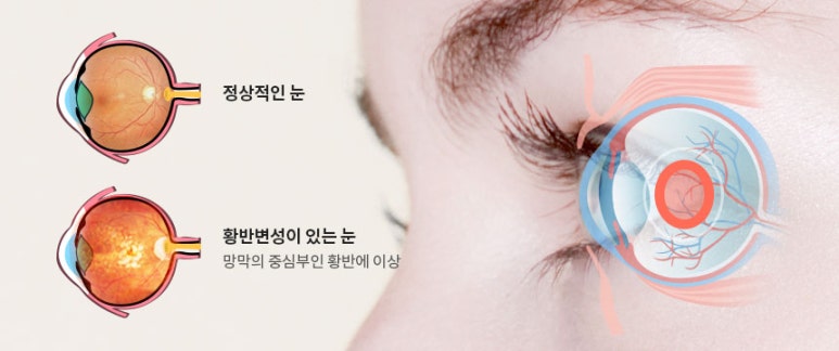 서울닥터윤치과 이미지