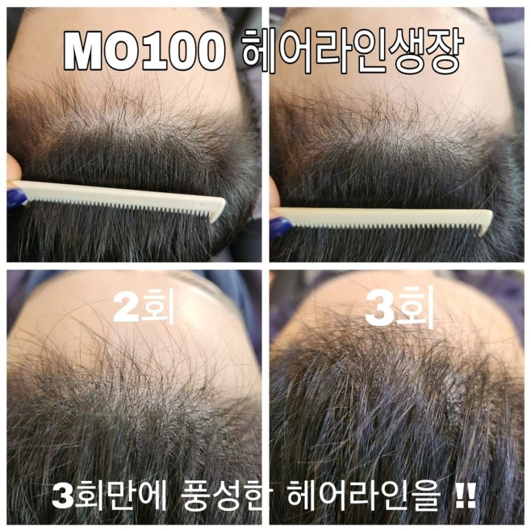 글로리아헤어 이미지