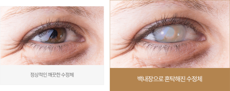 서울닥터윤치과 이미지