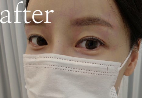 아레볼뷰티 이미지