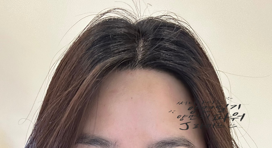 퀸헤어라인 이미지